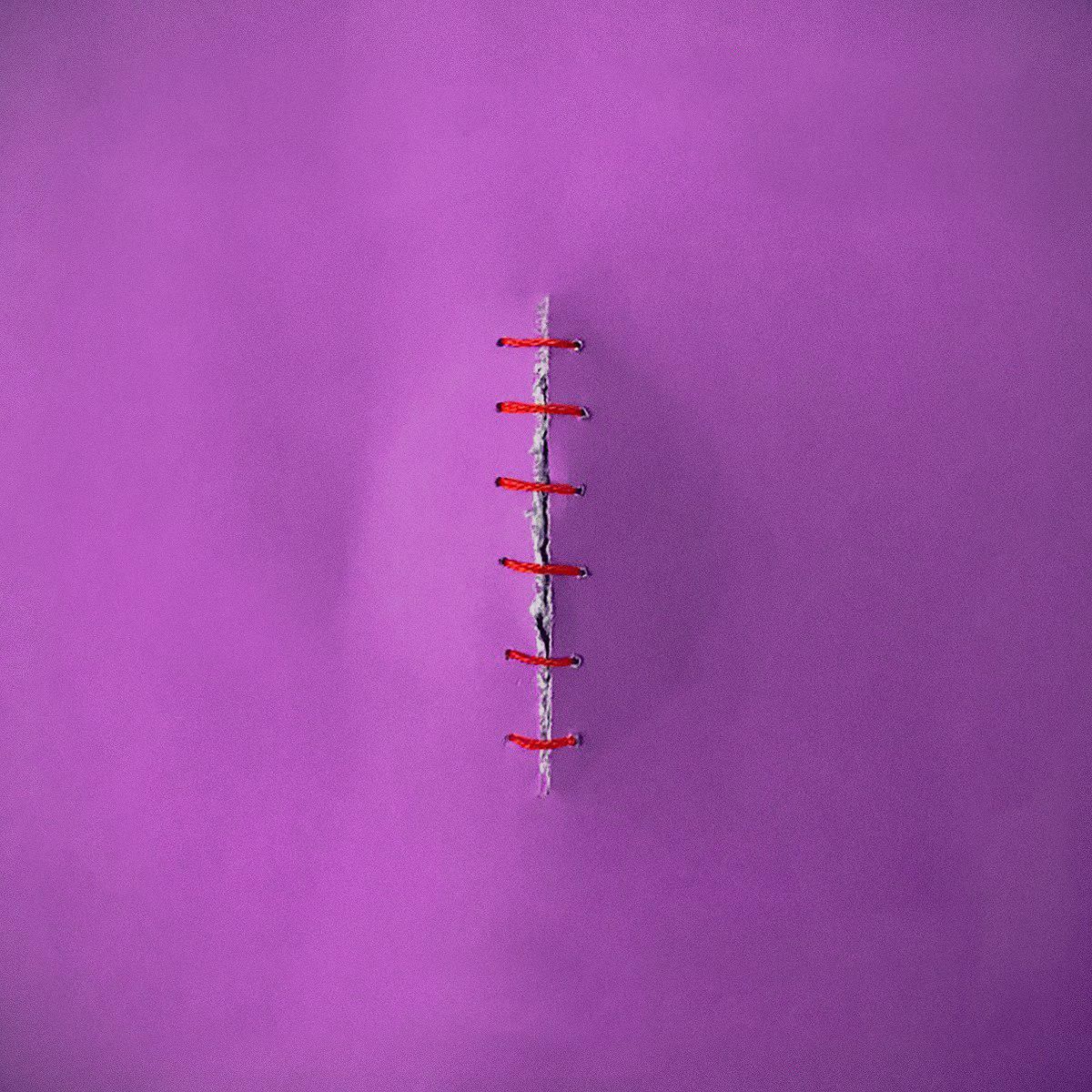 mutilacion2-1